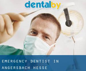 Emergency Dentist in Angersbach (Hesse)
