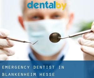 Emergency Dentist in Blankenheim (Hesse)