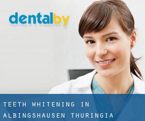 Teeth whitening in Albingshausen (Thuringia)