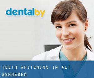 Teeth whitening in Alt Bennebek