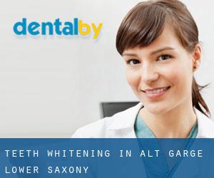 Teeth whitening in Alt Garge (Lower Saxony)