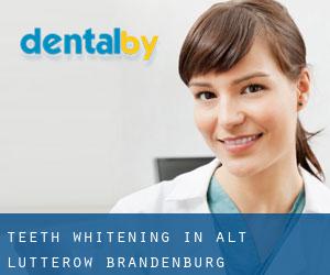 Teeth whitening in Alt Lutterow (Brandenburg)