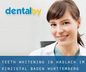Teeth whitening in Haslach im Kinzigtal (Baden-Württemberg)