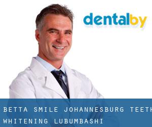 Betta Smile Johannesburg Teeth Whitening (Lubumbashi)
