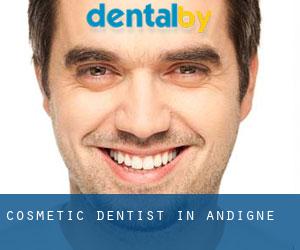 Cosmetic Dentist in Andigné