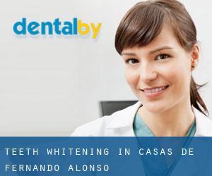 Teeth whitening in Casas de Fernando Alonso