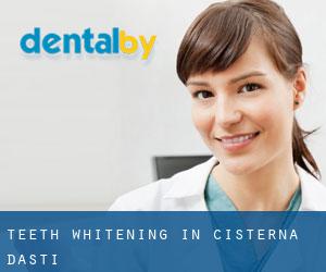 Teeth whitening in Cisterna d'Asti