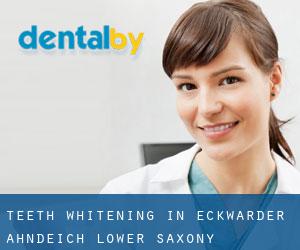 Teeth whitening in Eckwarder Ahndeich (Lower Saxony)