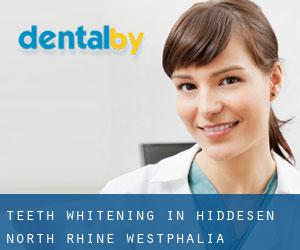 Teeth whitening in Hiddesen (North Rhine-Westphalia)