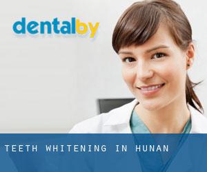 Teeth whitening in Hunan Teeth whitening in Hunan