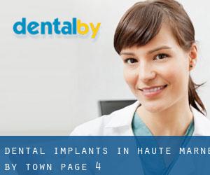 Dental Implants in Haute-Marne by town - page 4